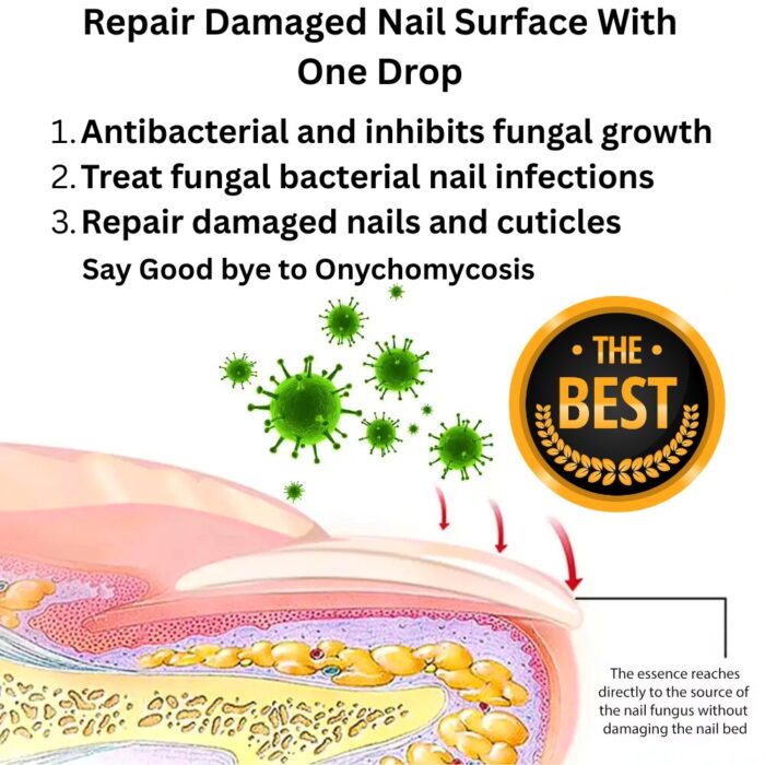 Enhanced Nail Fungus Treatment Serum 30ml – 7-Day Repair Solution, Natural Antifungal Nail Care - Image 3