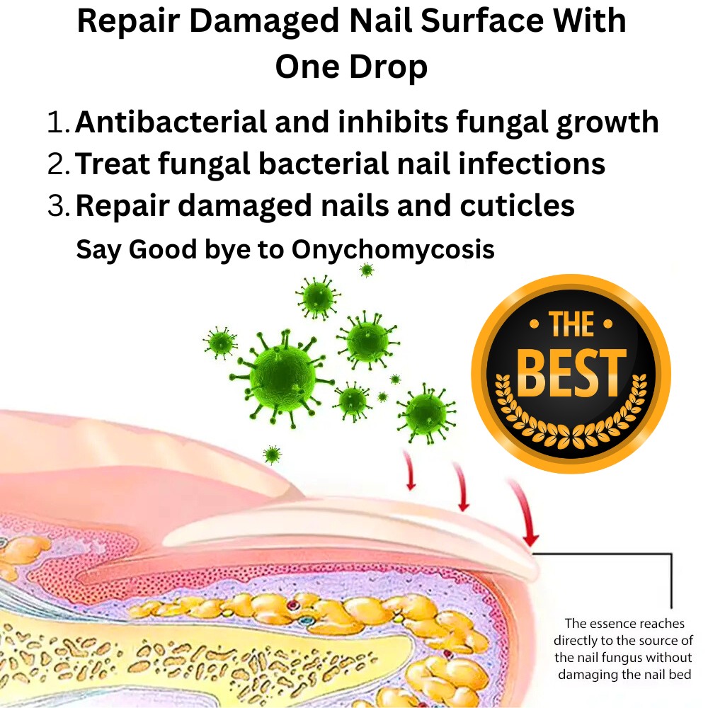 Enhanced Nail Fungus Treatment Serum 30ml glazmart (3) Enhanced Nail Fungus Treatment Serum 30ml – 7-Day Repair Solution, Natural Antifungal Nail Care - Image 3