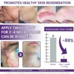 TIMILK Scarvanisher Scar Gel 30g – Advanced Scar & Stretch Marks Repair Gel – Fast Absorbing Skin Care Formula - Image 5