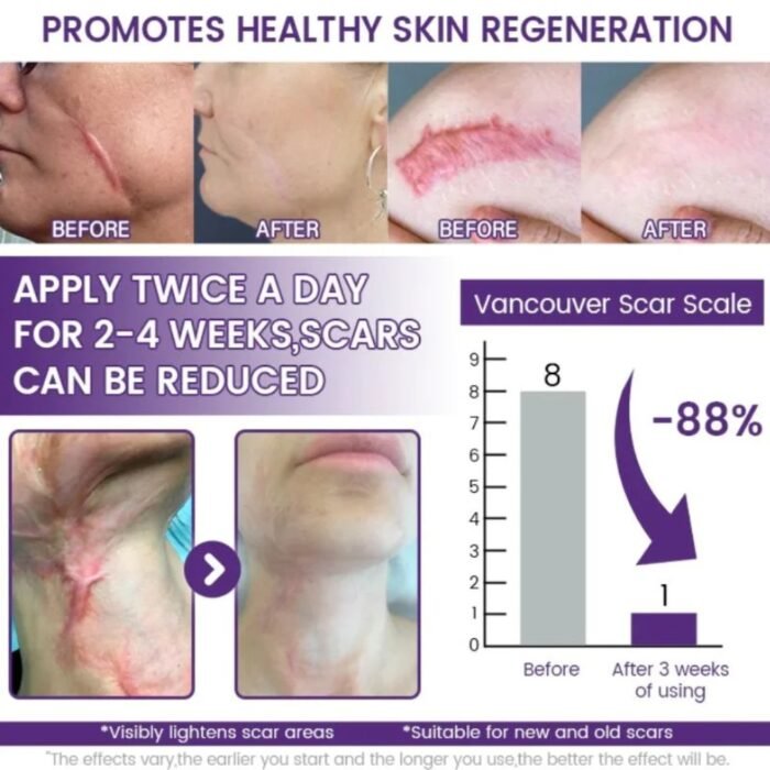 TIMILK Scarvanisher Scar Gel 30g – Advanced Scar & Stretch Marks Repair Gel – Fast Absorbing Skin Care Formula - Image 5