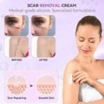 TIMILK Scarvanisher Scar Gel 30g – Advanced Scar & Stretch Marks Repair Gel – Fast Absorbing Skin Care Formula - Image 4