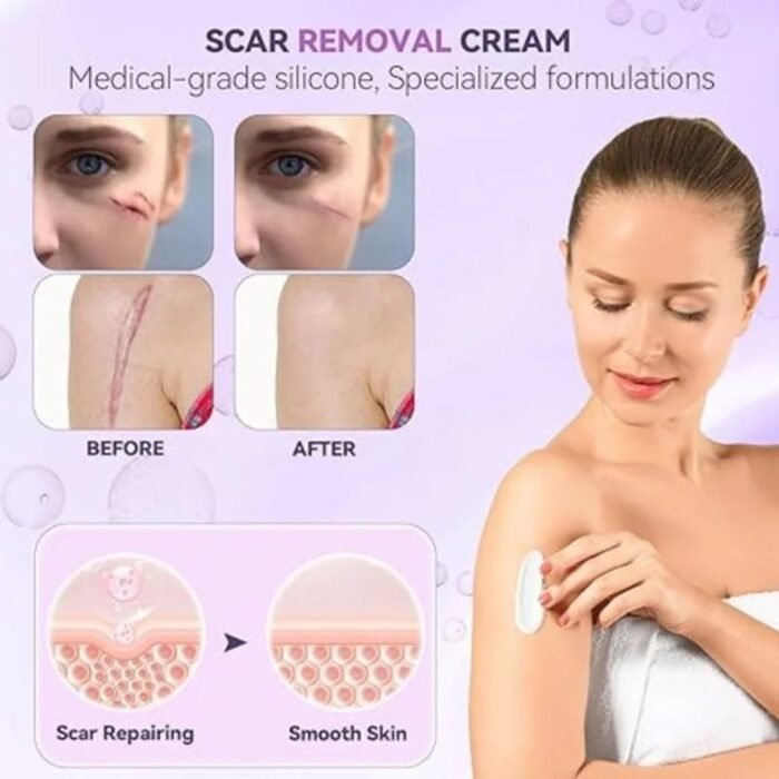 TIMILK Scarvanisher Scar Gel 30g – Advanced Scar & Stretch Marks Repair Gel – Fast Absorbing Skin Care Formula - Image 4