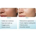 Pilgrim 32% AHA BHA PHA Peeling Solution 30ml, Facial Peel - Image 6