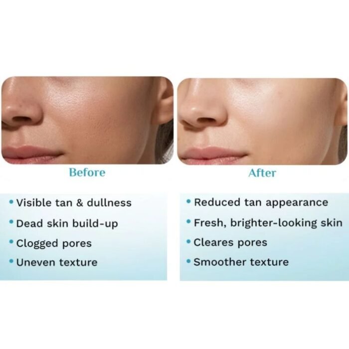 Pilgrim 32% AHA BHA PHA Peeling Solution 30ml, Facial Peel - Image 6
