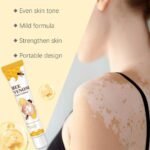 Vitigo Bee Venom Treatment Cream, Hydrating & Soothing Skin Care - Image 5
