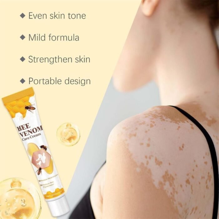 Vitigo Bee Venom Treatment Cream, Hydrating & Soothing Skin Care - Image 5