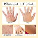 Vitigo Bee Venom Treatment Cream, Hydrating & Soothing Skin Care - Image 6