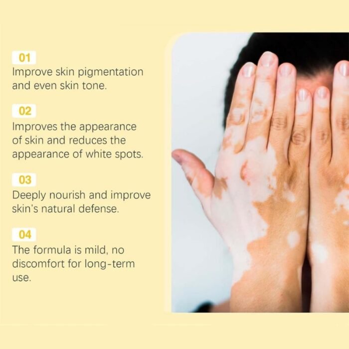 Vitigo Bee Venom Treatment Cream, Hydrating & Soothing Skin Care - Image 7