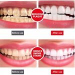 Yayashi SP-4 Ultra Whitening Toothpaste, Stain Remover & Fresh Mint Formula, 100g - Image 3