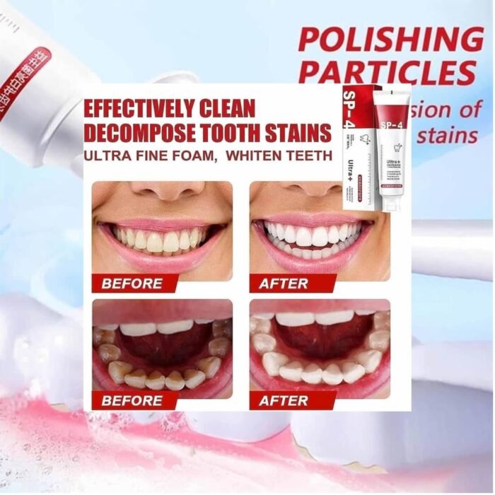 Yayashi SP-4 Ultra Whitening Toothpaste, Stain Remover & Fresh Mint Formula, 100g - Image 4